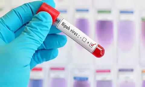 கேரளாவில் 2 பேருக்கு நிபா வைரஸ் அறிகுறிகள்; 3 மாவட்டங்களில் உஷார் நிலை