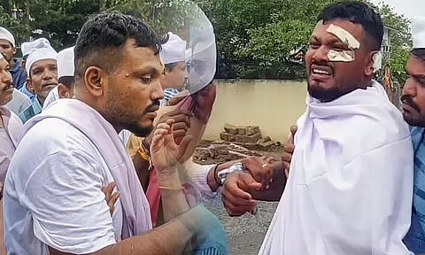 ஆமதாபாத் விமான விபத்தில் உயிர் தப்பியவருக்கு மனநல சிகிச்சை