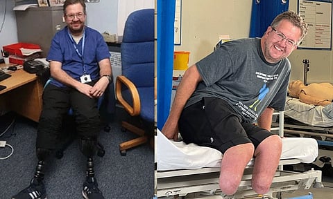 ரூ.5 கோடி காப்பீட்டு தொகைக்காக 2 கால்களை வெட்டிய நபர்: கண்டுபிடித்த காப்பீட்டு நிறுவனம்