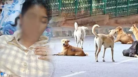 கல்லூரி மாணவியை கடித்துக் குதறிய தெருநாய்கள்; முகத்தில் 17 தையல்கள் போடப்பட்டு தீவிர சிகிச்சை