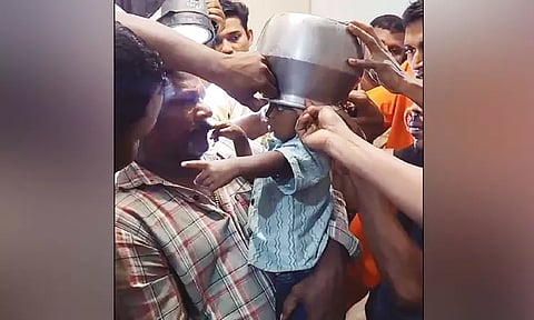 குழந்தையின் தலையில் சிக்கிய பாத்திரம்.. தீயணைப்பு வீரர்கள் போராடி அகற்றினர்