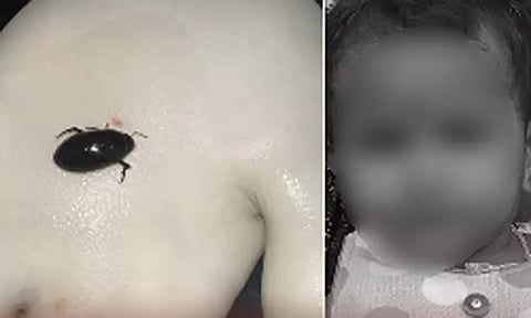 மூச்சுக்குழாயில் வண்டு கடித்து குழந்தை உயிரிழப்பு: திருவள்ளூர் அருகே சோகம்