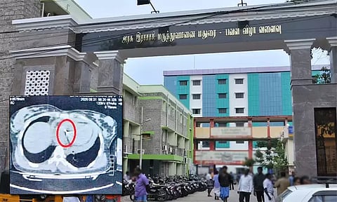 தவறி விழுந்த இளம்பெண்.. தரையில் கிடந்த ஊசி இதயம் வரை புகுந்ததால் அதிர்ச்சி