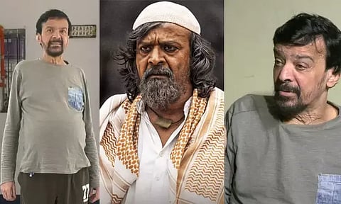 'KGF' actor looks unrecognizable...Fans worried