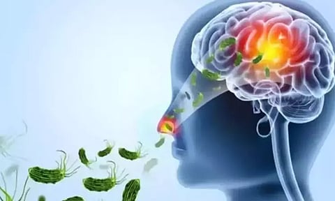 அமீபா மூளைக்காய்ச்சல் நோய்க்கு கேரளாவில் மேலும் ஒருவர் உயிரிழப்பு