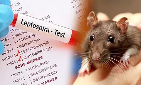 நெல்லையில் எலிக்காய்ச்சல் அறிகுறியுடன் கல்லூரி மாணவர்கள் 7 பேர் மருத்துவமனையில் அனுமதி