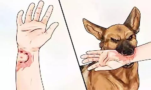 தூத்துக்குடியில் தெரு நாய் கடித்து 11 பள்ளி மாணவர்கள் காயம்