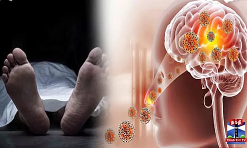 கேரளாவில் அமீபா மூளைக்காய்ச்சலுக்கு மேலும் ஒரு பெண் பலி