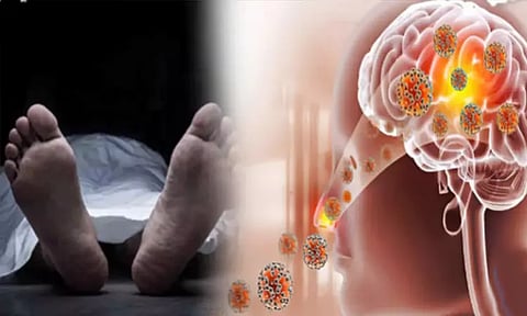 கேரளாவில் அமீபா மூளைக்காய்ச்சலுக்கு மூதாட்டி பலி