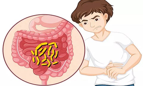 வயிற்றுக்குள் குடற்புழுக்கள் வராமல் தடுக்கும் வழிமுறைகள்