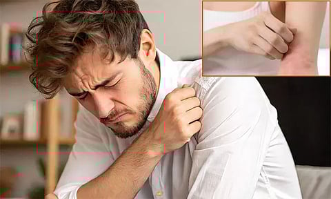 வியர்க்குருவை விரட்ட 10 எளிய வழிமுறைகள்