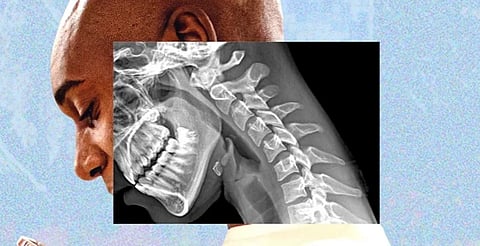 Photo shows a man’s neck impacted due to screentime. 