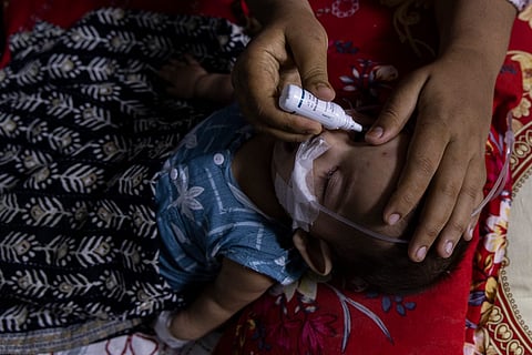 A child receives treatment for measles at a Shishu Hospital in Dhaka.