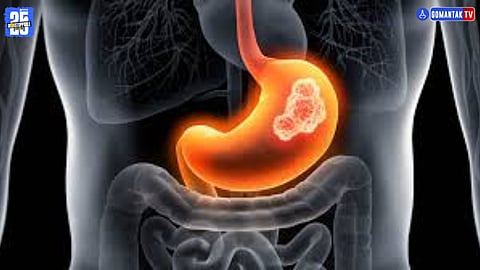 Cancer risk in India 2025 report

