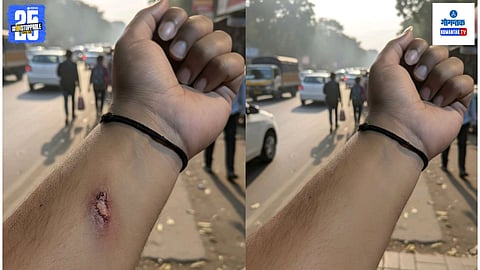 AI Fake Injury Photo