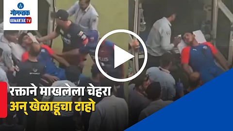 Delhi Capitals Net Bowler Injury