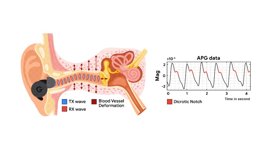 APG sends a low intensity ultrasound transmitting wave (TX wave) using an ANC headphone's speakers and collects the receiving wave (RX wave) via the on-board feedback microphones. The APG signal is a pulse-like waveform that synchronizes with heartbeat and reveals rich cardiac information, such as dicrotic notches.