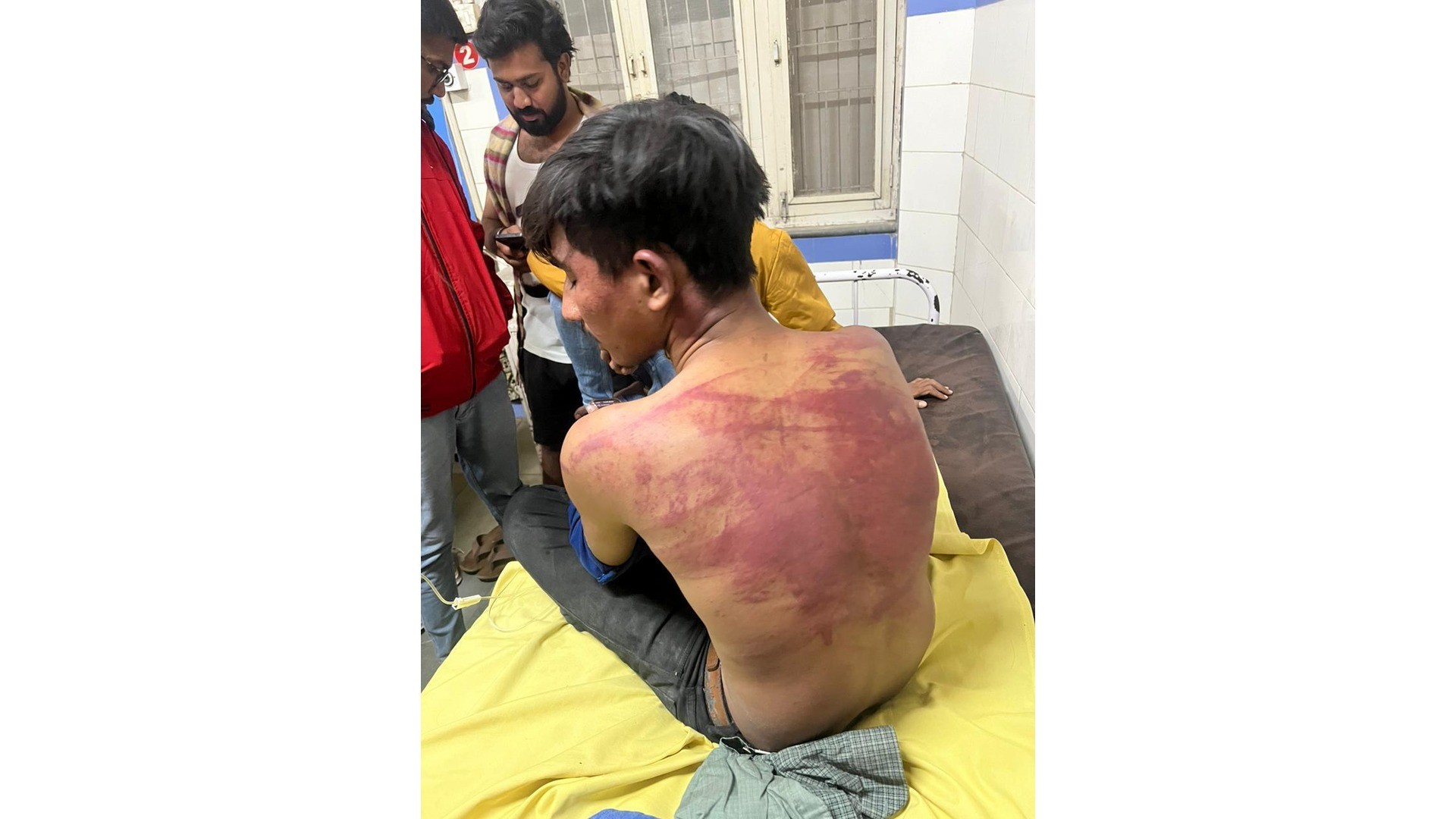 Gujarat woman assaults Dalit ex-employee, forces him to hold slipper in mouth for demanding wage