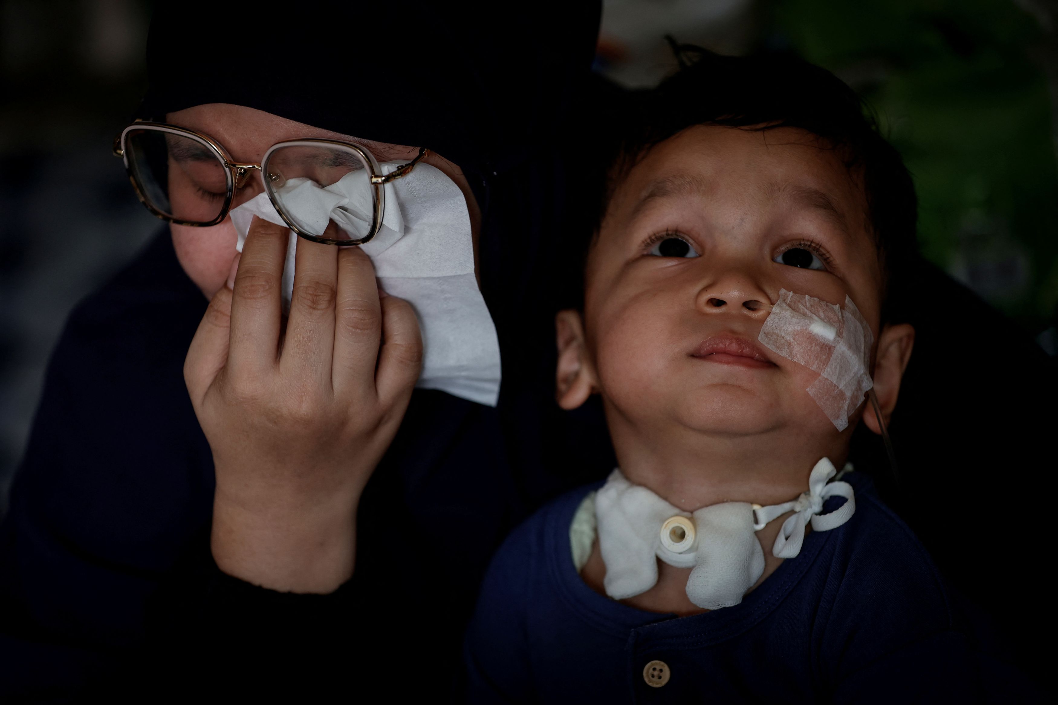 Resti Safitri, 28, wipes her tears during an interview with Reuters about her son Rayvan Aji Pratama, 2, who was prescribed contaminated cough syrup last year, at home in Jakarta, Indonesia, October 7, 2023. Last year,Rayvan was one of more than 300 children from Gambia to Uzbekistan found by health authorities to have been poisoned by contaminated cough syrups, in one of the largest episodes of such contamination on record; Rayvan now requires care 24 hours a day, seven days a week.    