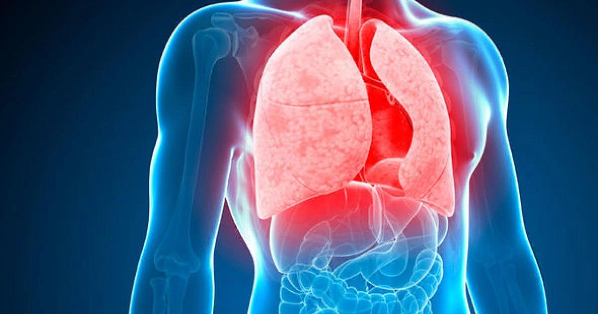 TB screening in Puducherry TB screening in Puducherry