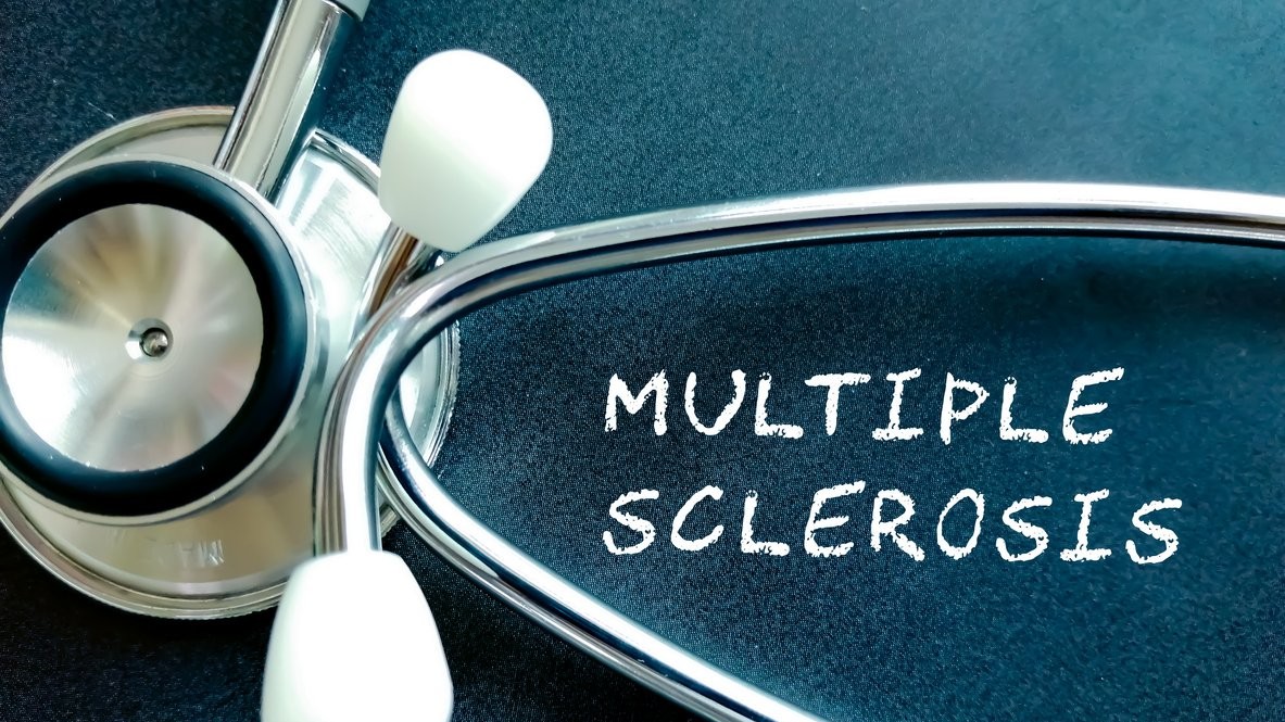 Coping with multiple sclerosis: Expert warns of no definitive cure