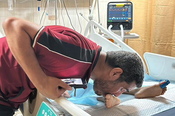 A father kisses his injured child's, Tawfik Abu Youssef, foot as he lies in bed, in Al-Aqsa Martyrs Hospital, in the aftermath of an Israeli strike, amid the Israel-Hamas conflict, in Deir Al-Balah, in the central Gaza Strip