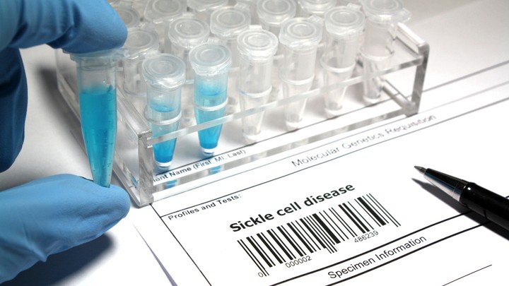 Pension benefit to sickle cell anemia affected people in Jharkhand's Khunti