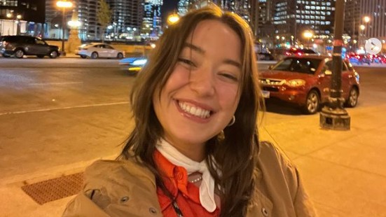 Instagram influencer having Ehlers–Danlos Syndrome shares how she dislocates shoulder to sleep