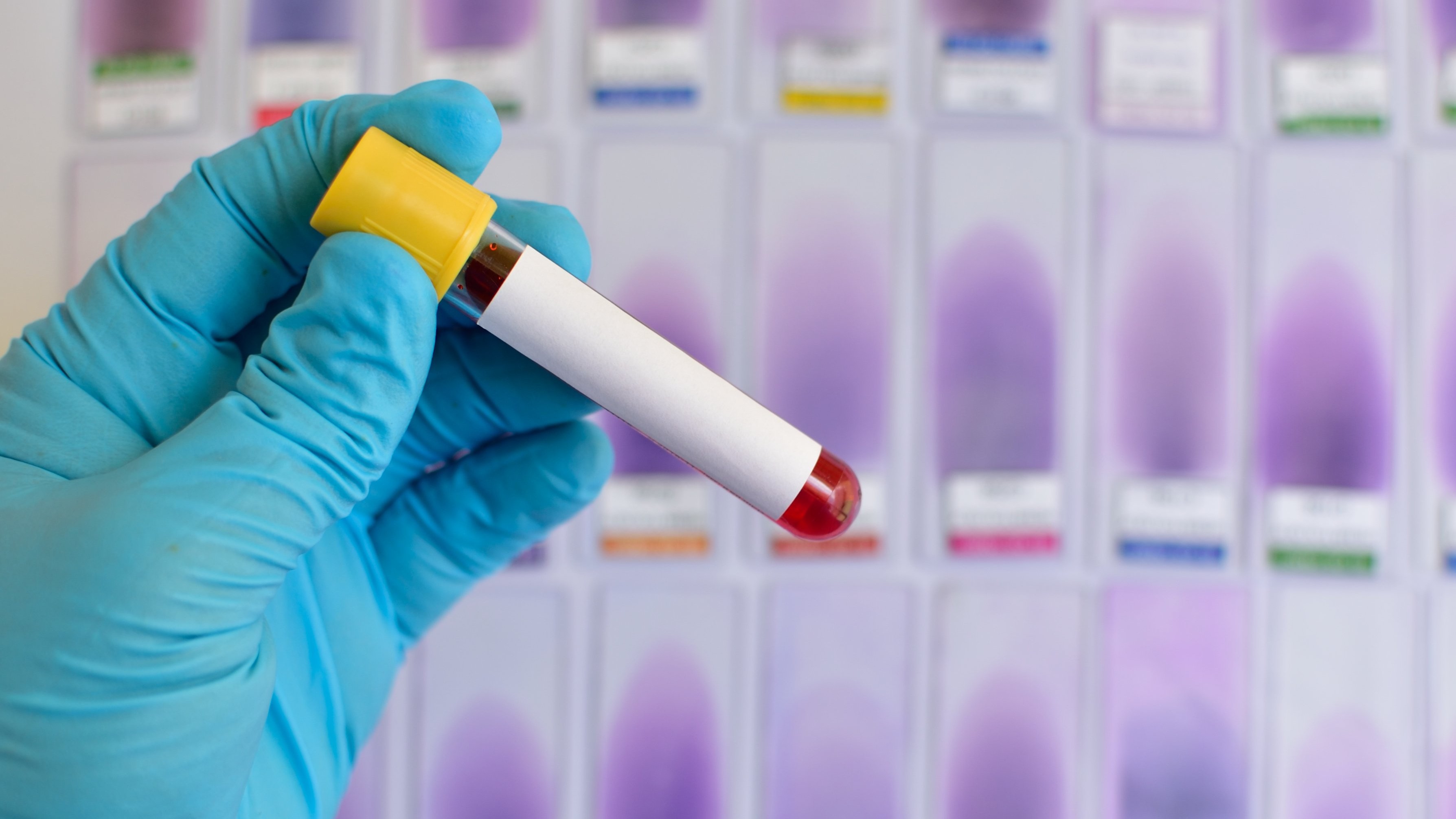Private hospitals unhappy, but agree to abide by dengue test price cap