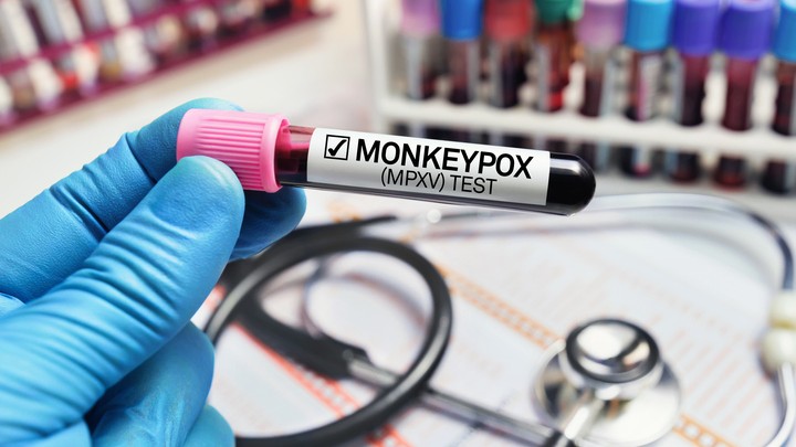 Mpox virus detected in Pakistan, health authorities say