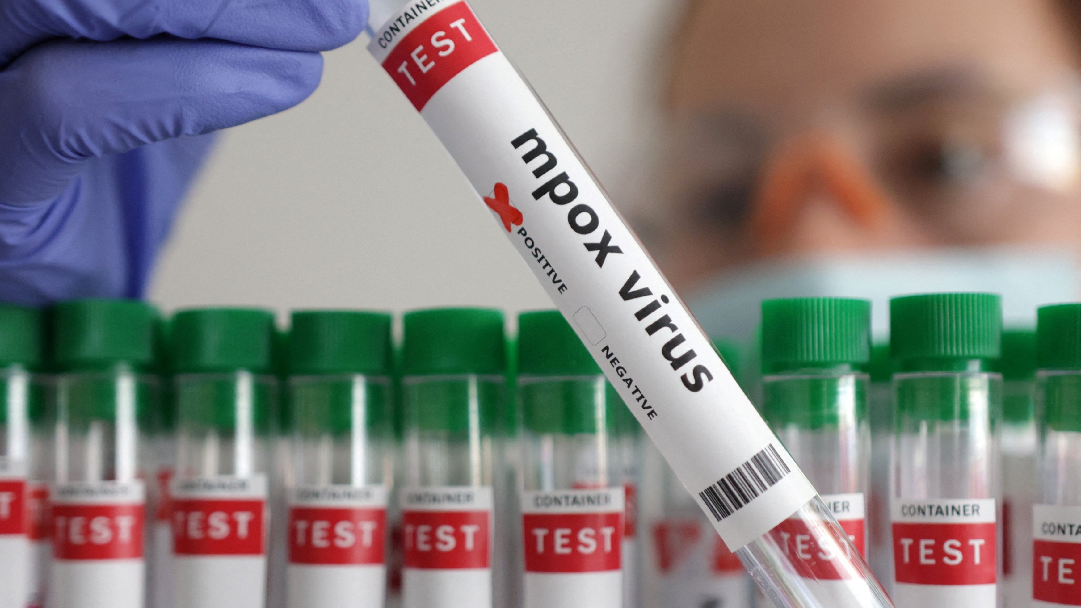 Africa could start mpox vaccinations within days, health agency says