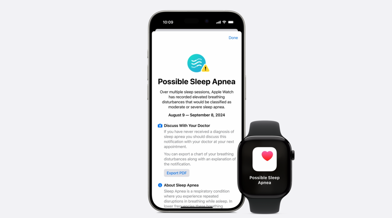 Apple Watch series 10