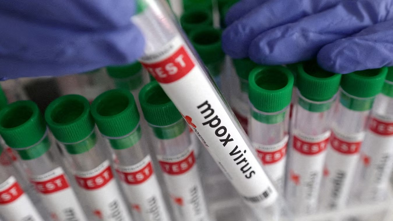 Tamil Nadu youth from UAE tested negative for mpox: Health Minister Subramanian