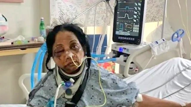 US man attacks Indian-origin nurse; breaks almost every bone in face
