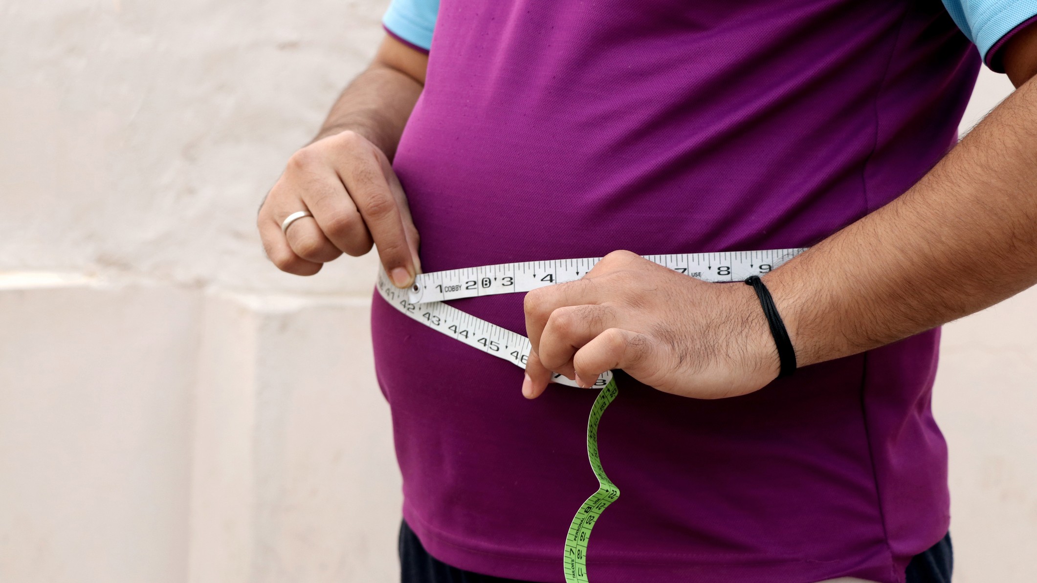 Homoeopathy vs obesity: Holistic, preventive strategy can address obesity 