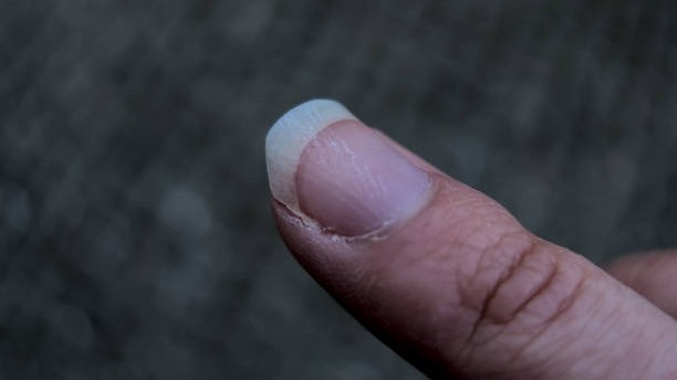 Kolkata college gang-rape: Doctors find marks of nail scratch on prime accused's body