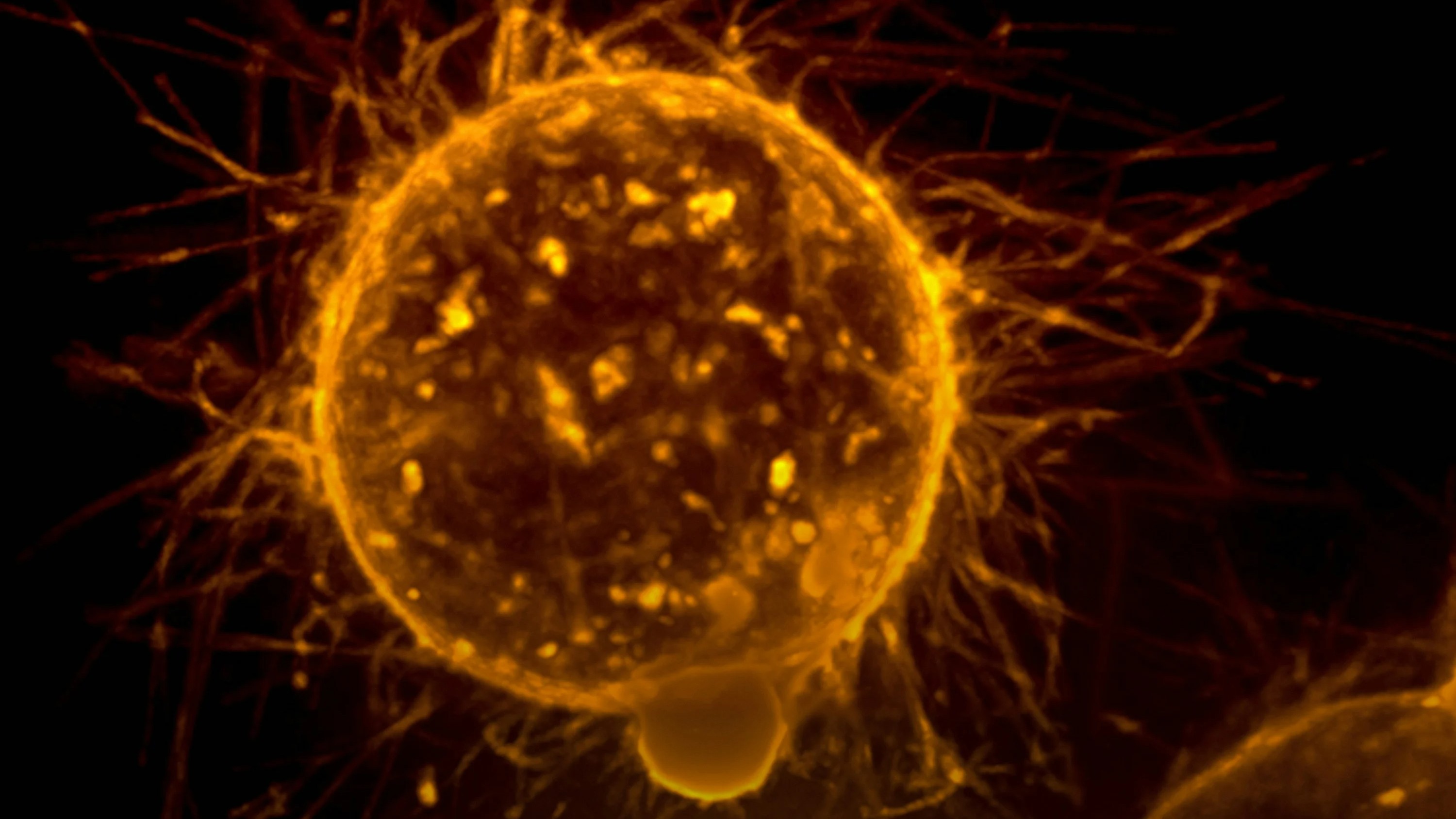 From health insurance to the struggles of families: Cancer's hidden costs