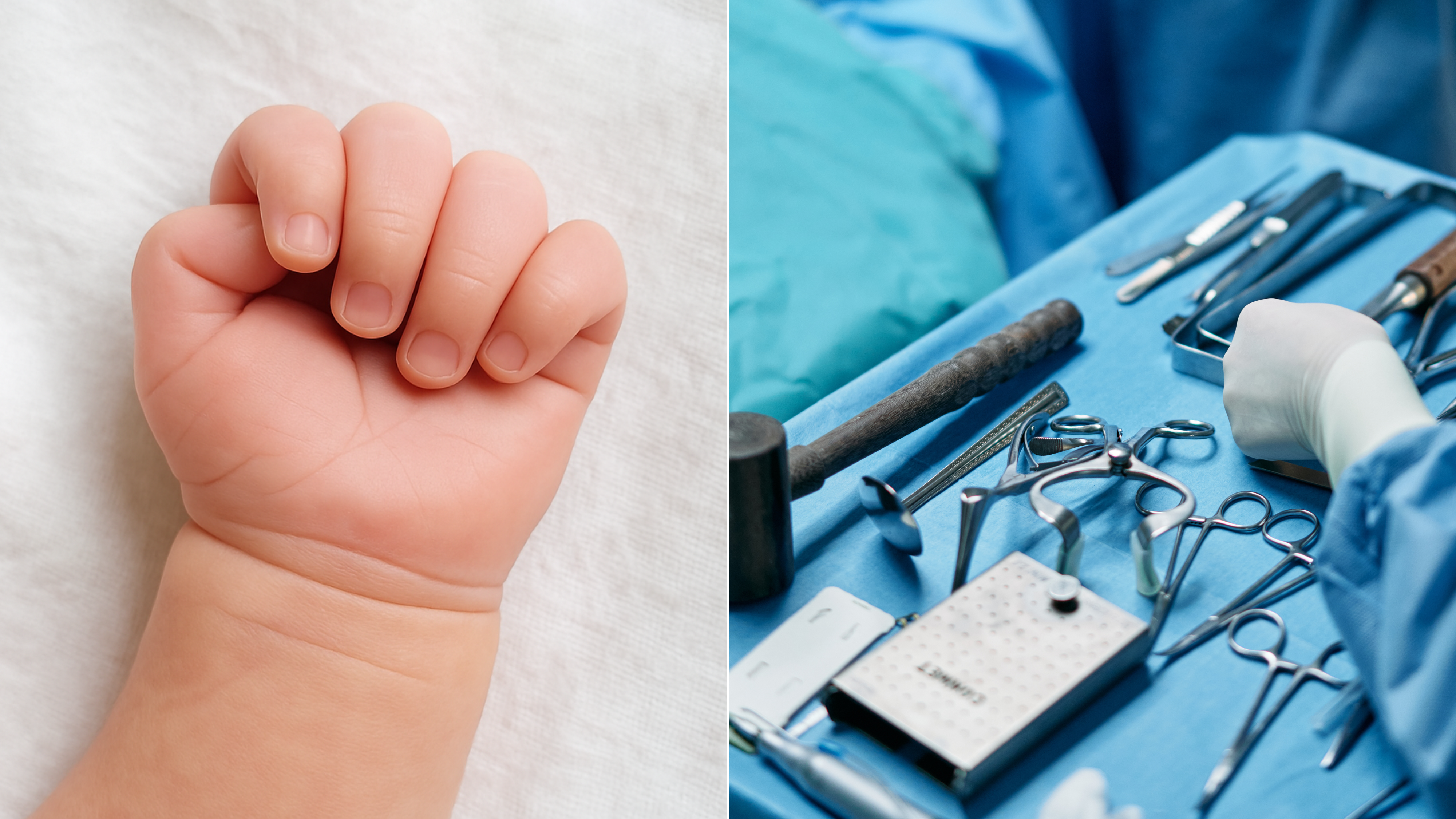 Medical negligence: Baby loses 5 fingers; hospital, doctor ordered to pay compensation