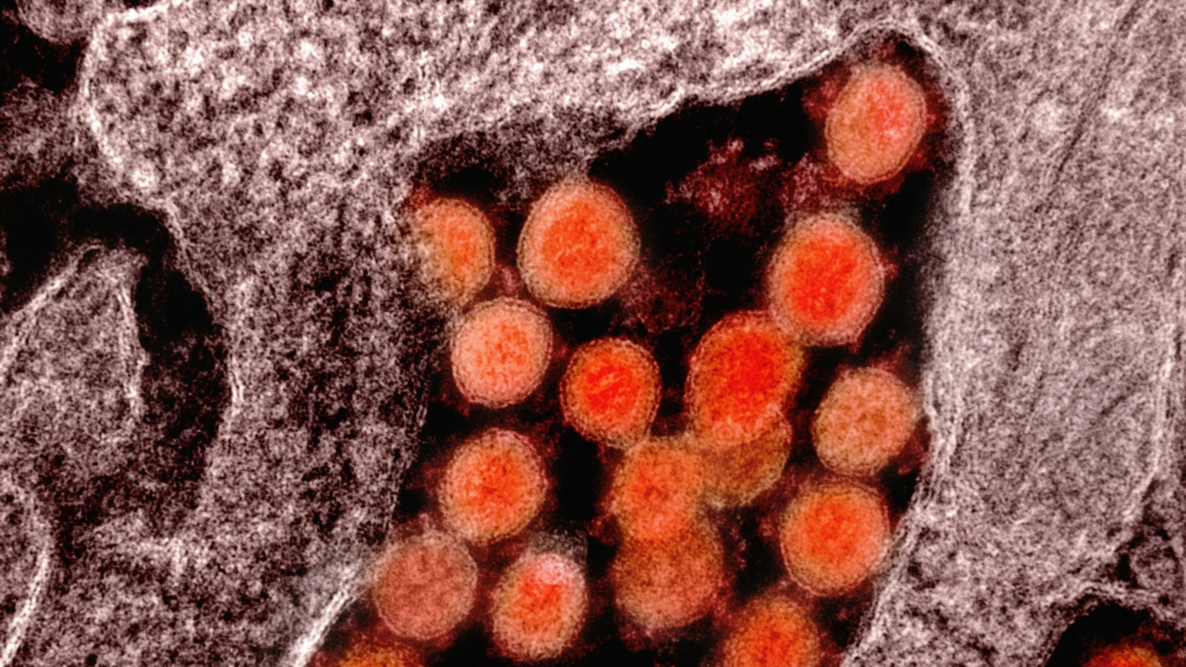 Transfusing Life: Tackling the global blood shortage for Thalassaemia patients