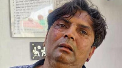 Man accused of attacking Delhi CM Rekha Gupta sent to 5 days' police custody