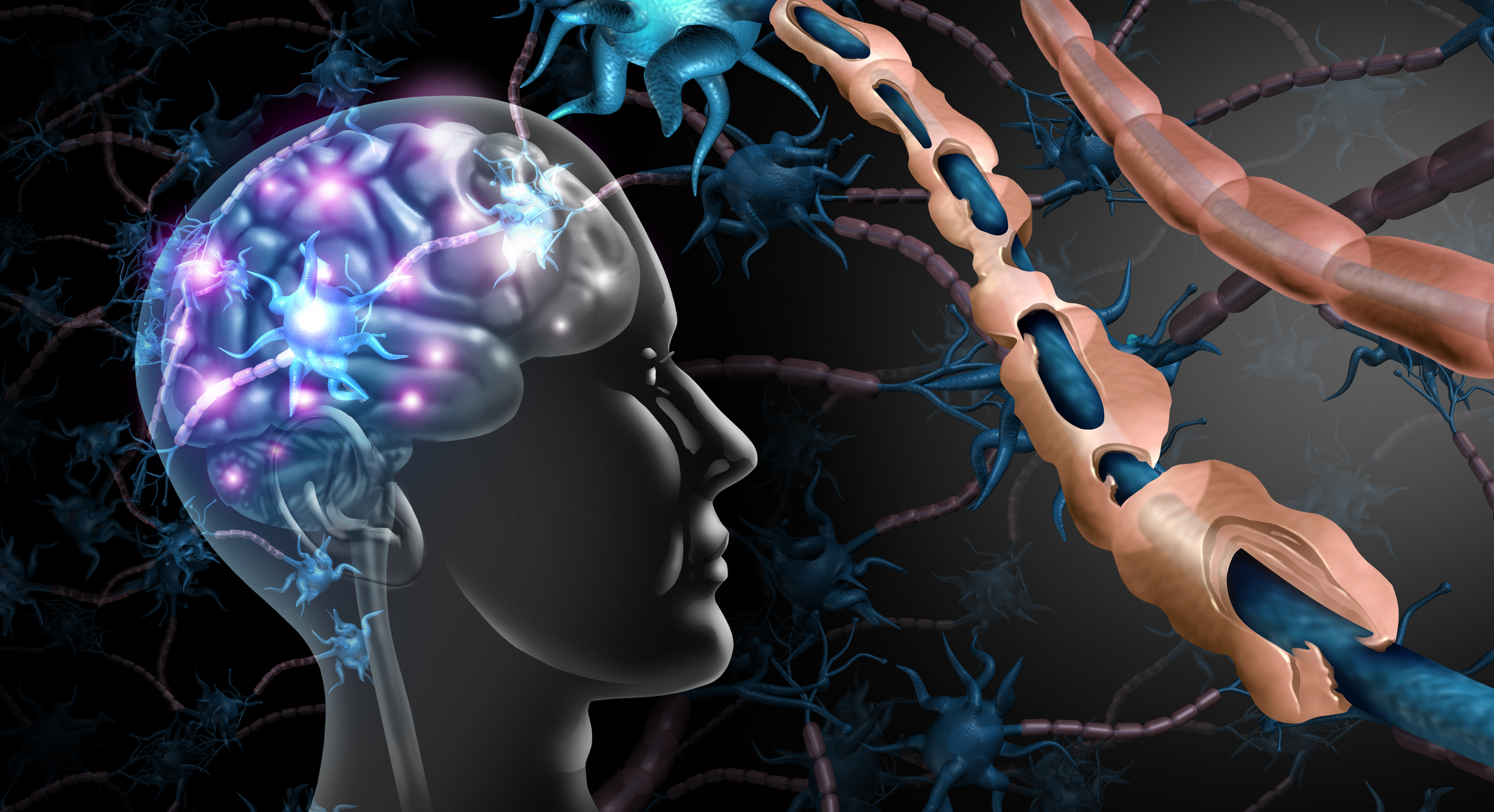 Bengaluru medical conference: Experts call for early intervention as Multiple Sclerosis cases rise in India