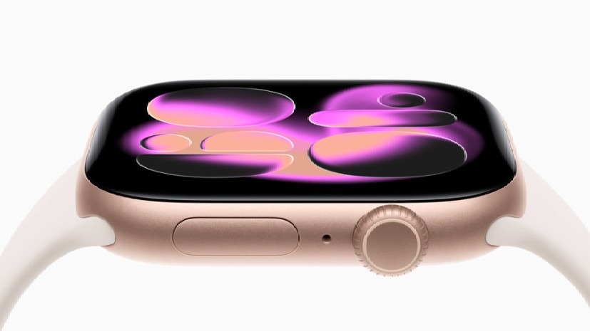Apple Watch Series 11.