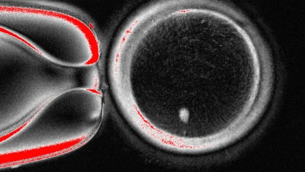 Making eggs out of human skin cells