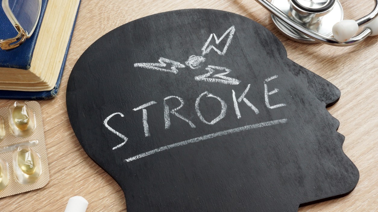 Bengaluru: Doctors see increase in stroke cases among youngsters