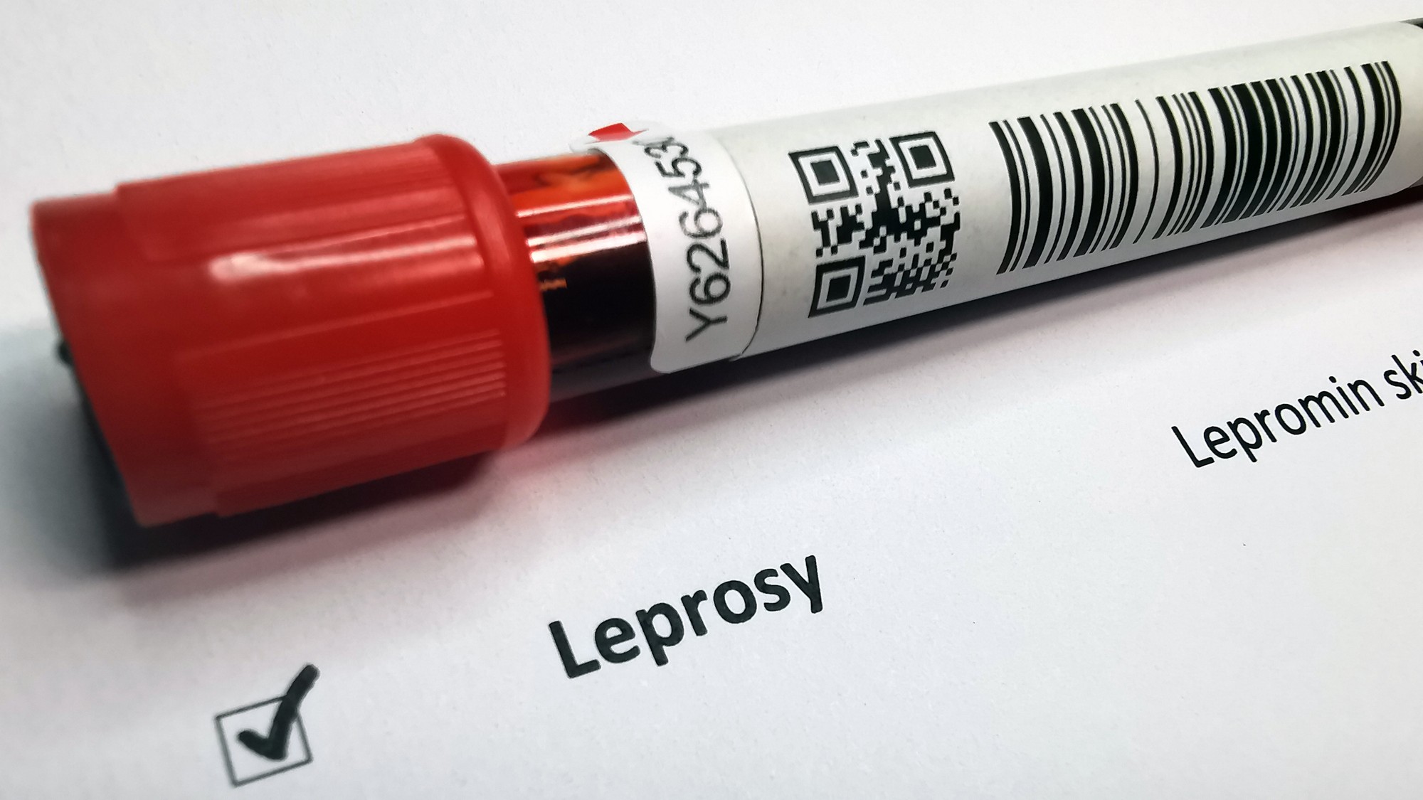 Leprosy declared 'notifiable disease' in Maharashtra 
