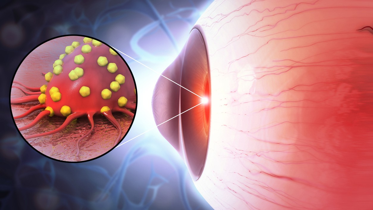 Man’s eye bulge misdiagnosed as thyroid issue; doctors remove grape-sized tumour