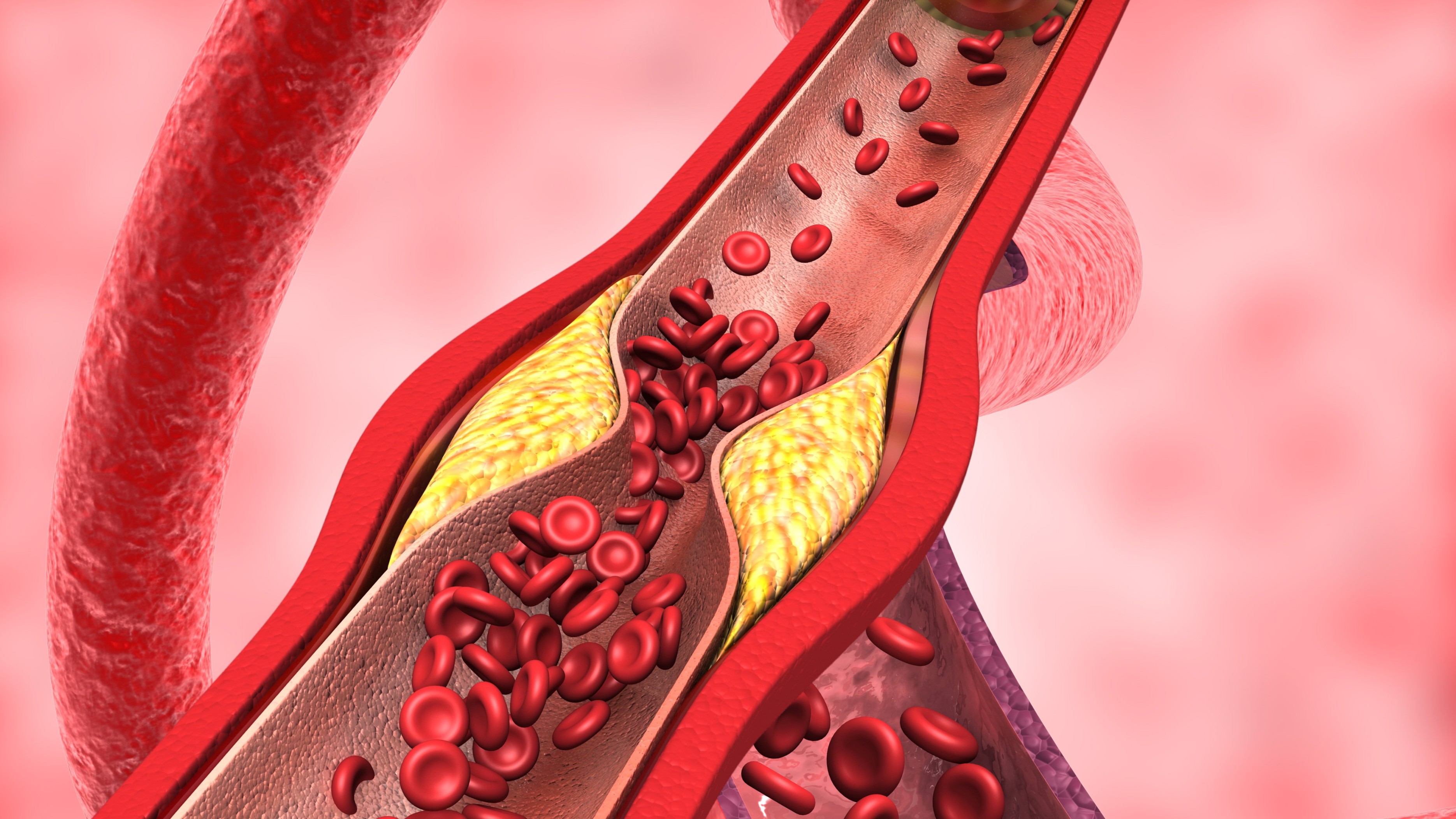 Bid goodbye to bad cholesterol