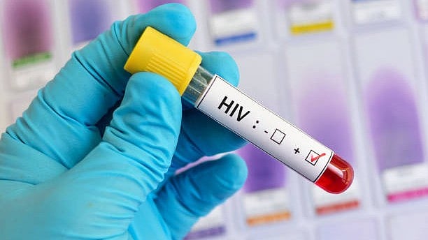 Karnataka HIV Prevalence: Above National Average | Deccan Herald