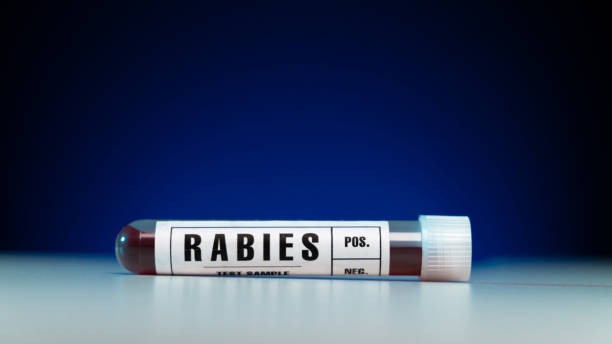 Gujarat man diagnosed with rabies shows signs of animal-like behaviour; hospitalised