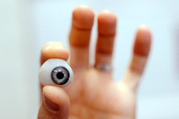 Ocularist and Director of Suil Nua optical Peter O'Gorman holds up an artificial eye at his clinic in Dublin, Ireland.